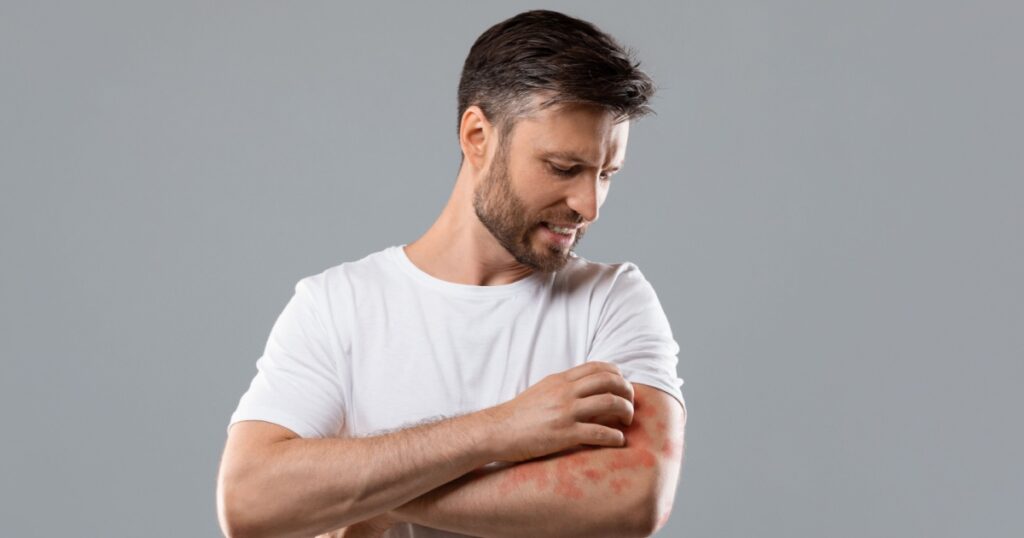 Dermatitis, eczema, allergy, psoriasis concept. Annoyed middle-aged man in white t-shirt scratching itch on his arm, grey studio background. Bearded man itching rash on his elbow, copy space