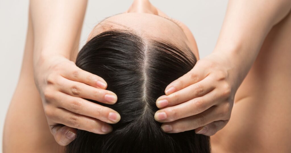A woman is massaging the scalp.