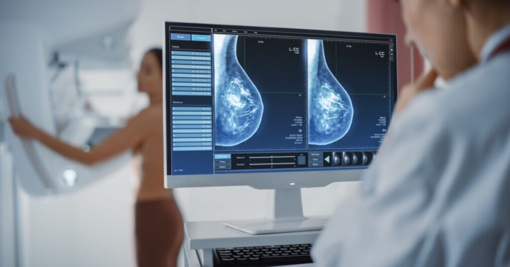 Computer Screen in Hospital Radiology Room: Beautiful Multiethnic Adult Woman Standing Topless Undergoing Mammography Screening Procedure. Screen Showing the Mammogram Scans of Dense Breast Tissues.