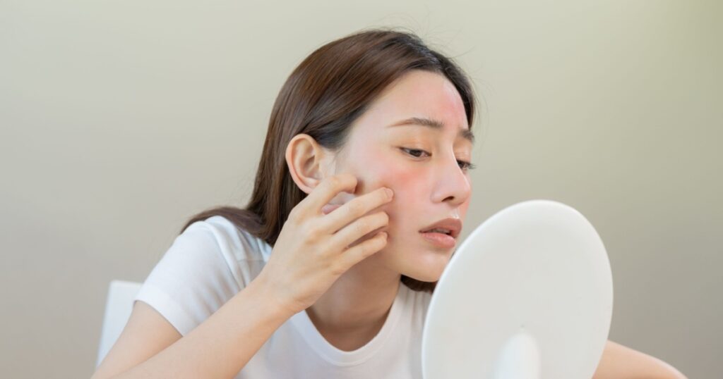 Dermatology, puberty asian young woman, girl looking into mirror, allergy presenting an allergic reaction from cosmetic, red spot or rash on face. Beauty care from skin problem by medical treatment.