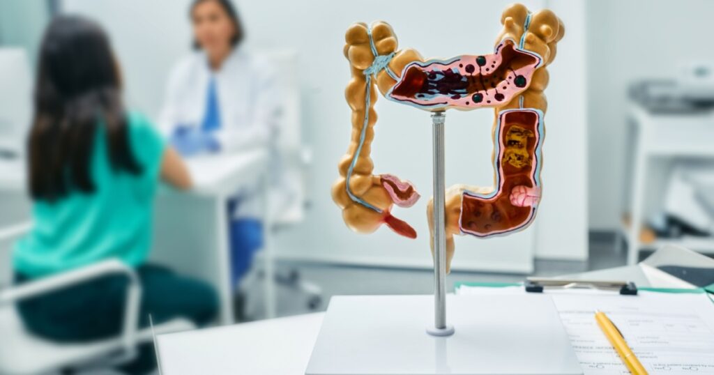 Gastroenterology consultation. Anatomical intestines model on doctor table over background gastroenterologist consulting female patient at medical clinic
