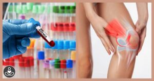 Early Warning Signs Your Body Needs Vitamin-C lab technician holding vile of blood labelled anemia, and someone grabing their knee in pain. Vitamin C deficient concept