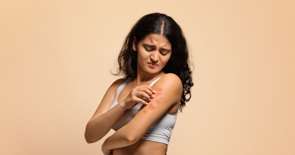 Dermatitis, eczema, allergy, psoriasis concept. Annoyed young indian woman scratching irritated skin on arm, eastern female having itching rash on body, standing on beige studio background