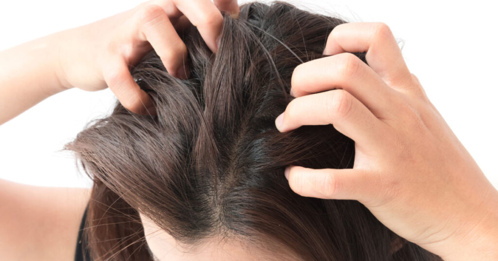 Closeup woman hand itchy scalp, Hair care concept