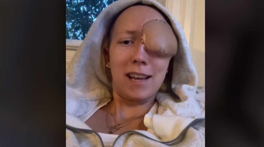 Annika, a 28-year-old woman from California, shares a harrowing tale of battling a deadly sinus cancer