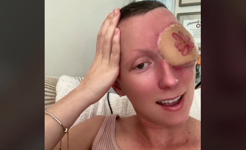 Annika, a 28-year-old woman from California, shares a harrowing tale of battling a deadly sinus cancer