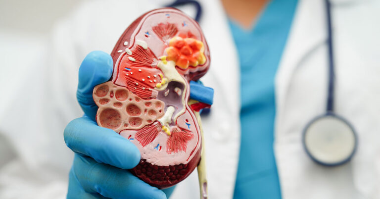 Risk Factors & Early Warning Signs of Chronic Kidney Disease - Featured image