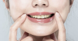 People Often Make This Mistake Which Leads to Yellow Teeth, Dentist Says woman smiling