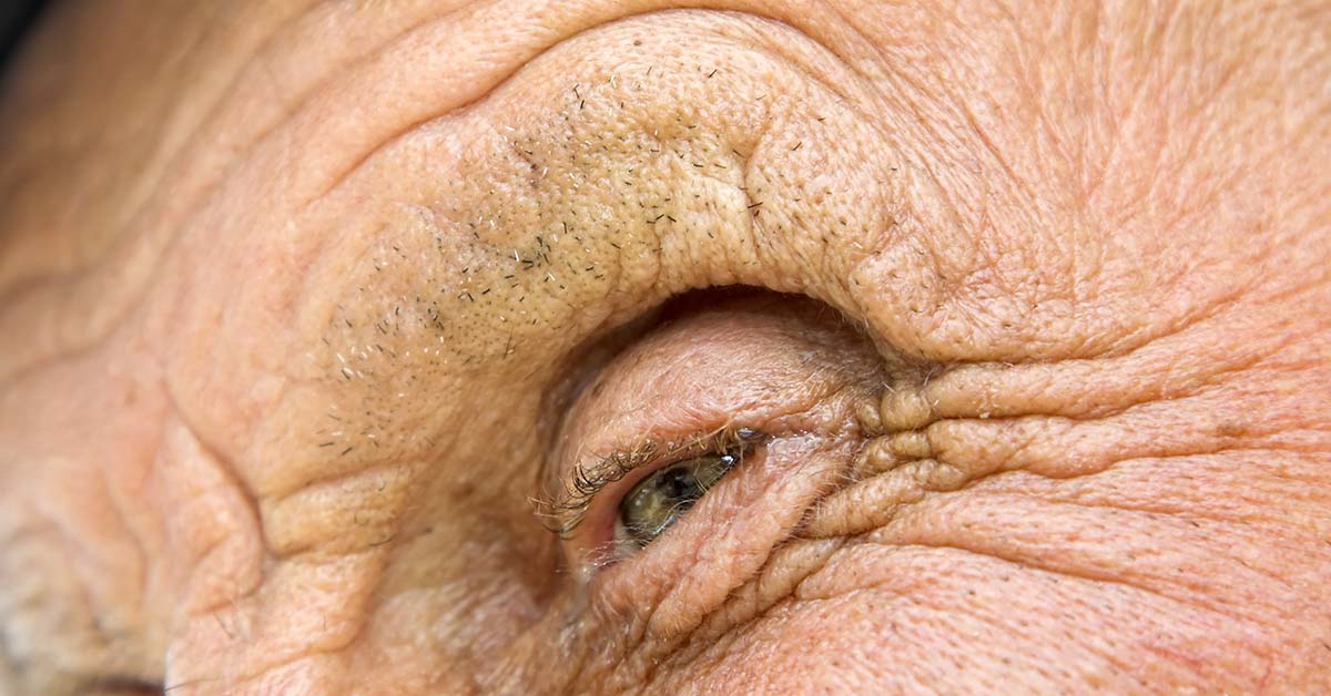 close up of Elderly person's face