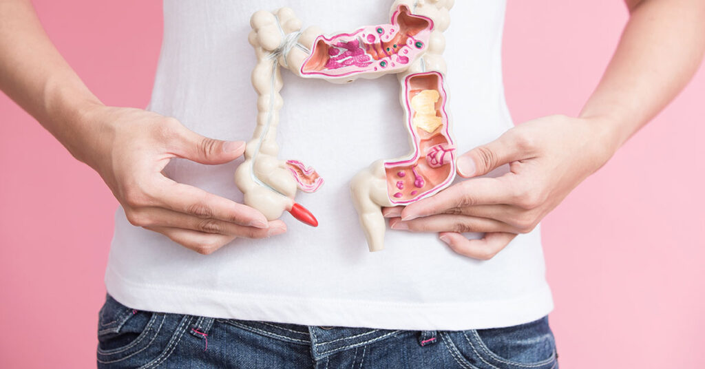 More and More Young People Are Getting Early-Onset Colorectal Cancer. Here’s What You Should Know. - Featured image