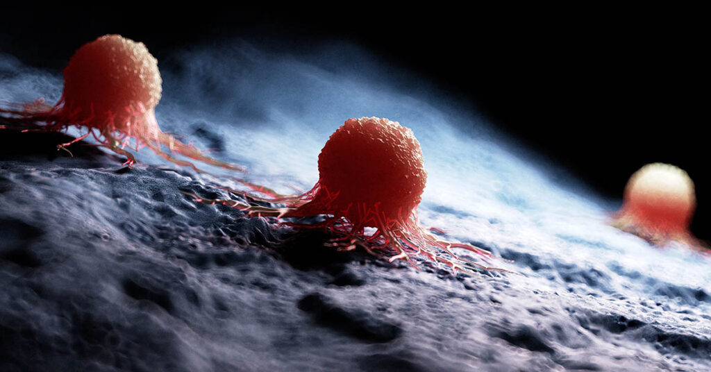 Cancer is Adaptive and Can Switch Sugar for Fatty Acids to Spread Around the Body - Featured image