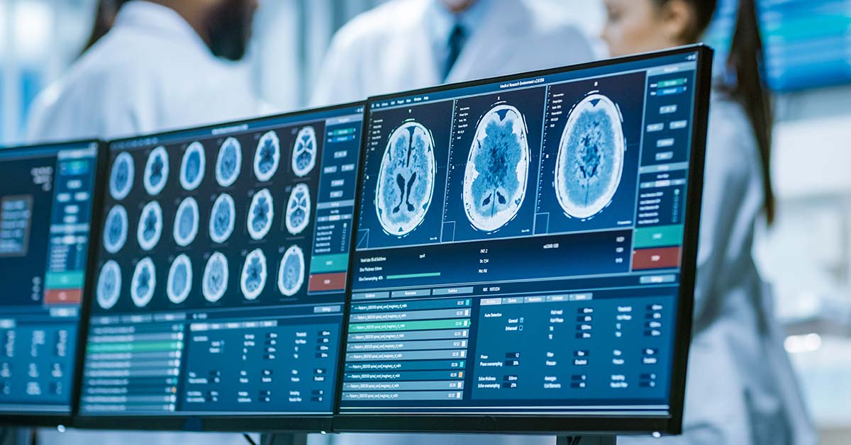 various brain scans displayed computer screens. Medical setting