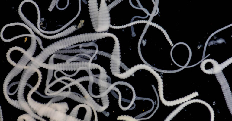 How Do You Know If You Have a Tape Worm? (Symptoms, Causes, and Treatment Options) - Featured image