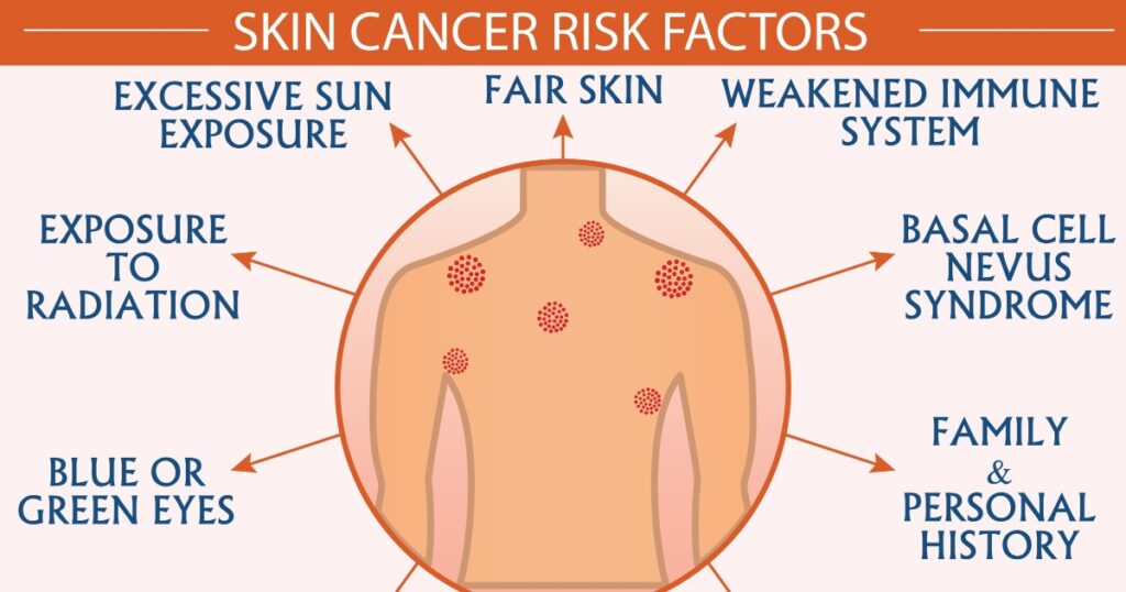 Skin cancer disease risk factors infographic vector illustration. Diagnosis, prevention, symptoms, and treatment concept. Flat style medical template. Hand-drawn awareness month, and health design.