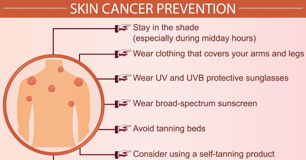 Skin cancer disease prevention infographic vector illustration. Protection, treatment, diagnosis, and symptoms concept. Flat style medical template. Hand-drawn awareness month, and health design.