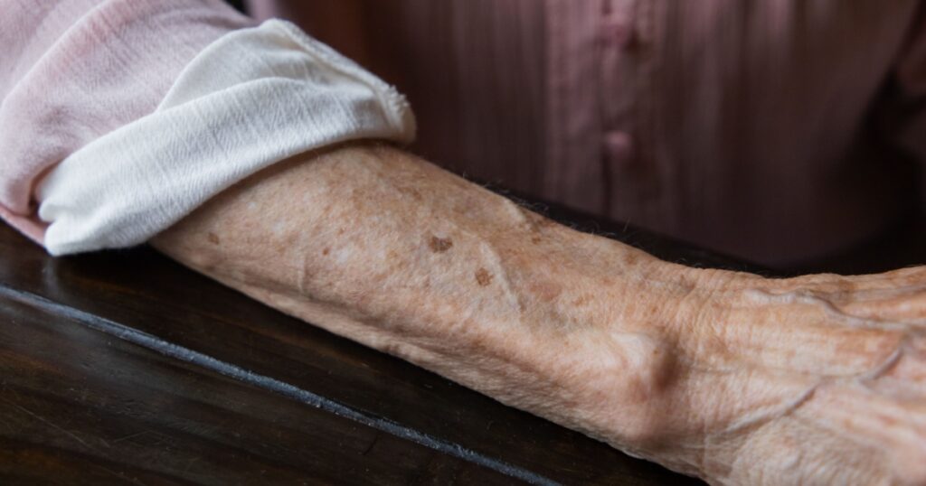 Anf elderly woman grandmother's arm with wrinkles and age spots.