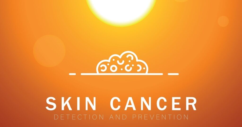 Skin cancer awareness and sun. Risk factors and treatment, Prevention. Exposure to ultraviolet (UV) rays causes most cases of melanoma, the deadliest kind of skin cancer. Disease and sun