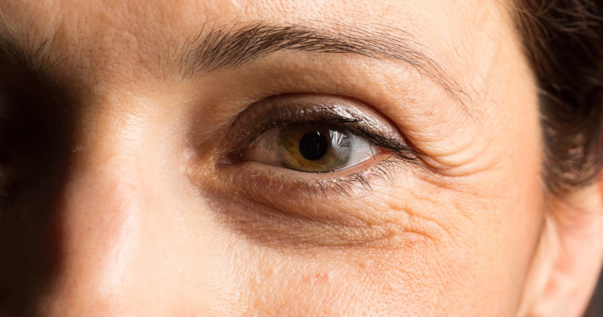 Lady eye with wrinkles