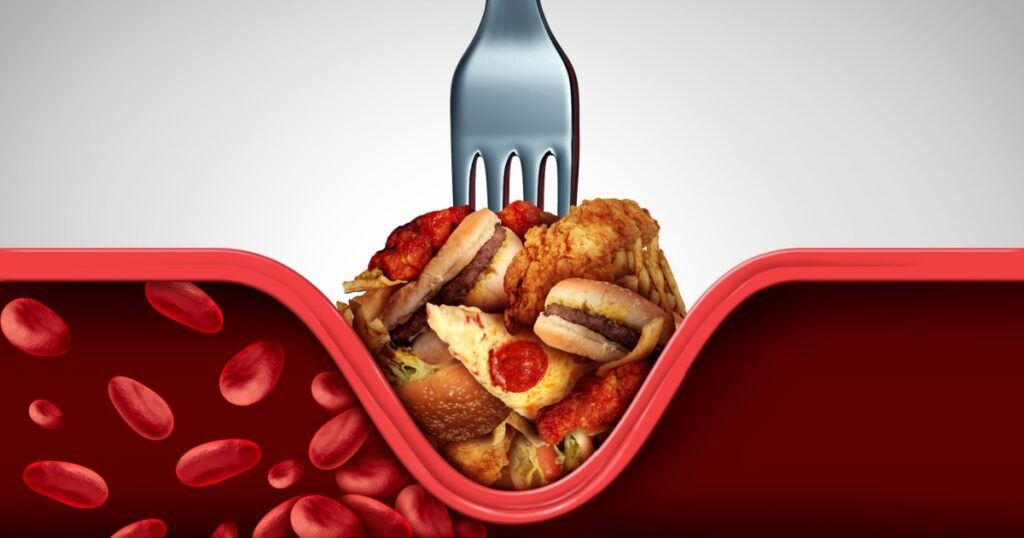 Experts Say These Are The 5 Worst Foods For Your Cholesterol - Featured image