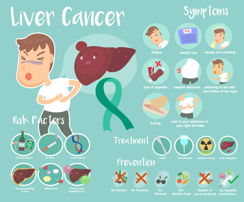 Cute info graphic of Liver Cancer 