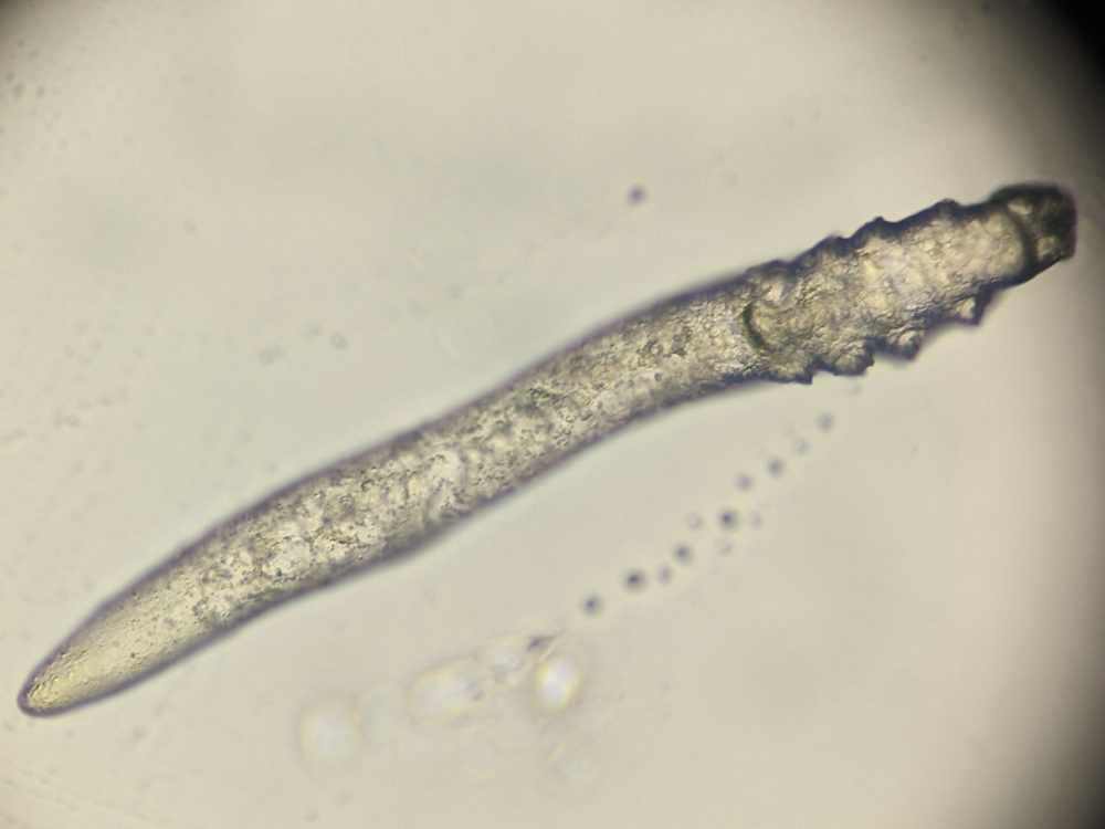photo of demodex human face parasite under the microscope
