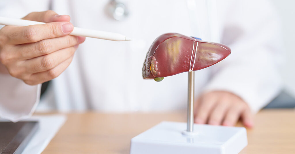 Liver Disease Can Move Silently – Here Are The Early Symptoms to Look Out For - Featured image