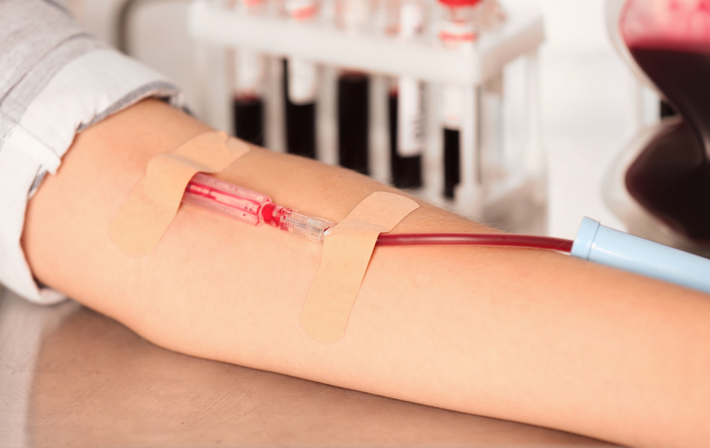 Woman making blood donation at hospital, closeup