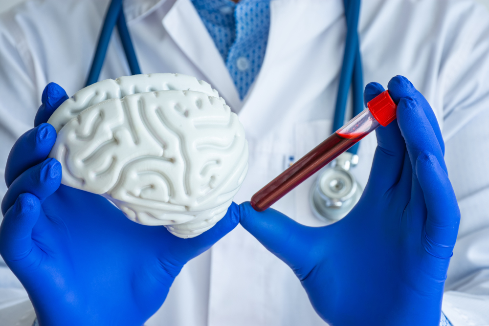 Laboratory medical diagnostics, tests for brain and neurological system concept photo. Doctor or laboratory technician holds in one hand laboratory test tube with blood, in other - figure of brain
