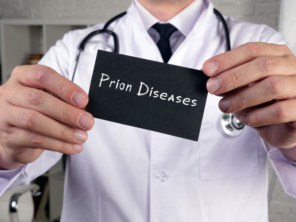 Conceptual photo about Prion Diseases  with handwritten phrase.
