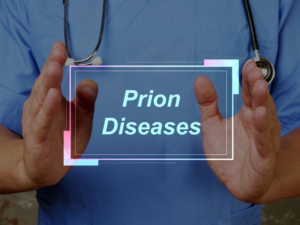 Health care concept about Prion Diseases with inscription on the sheet.
