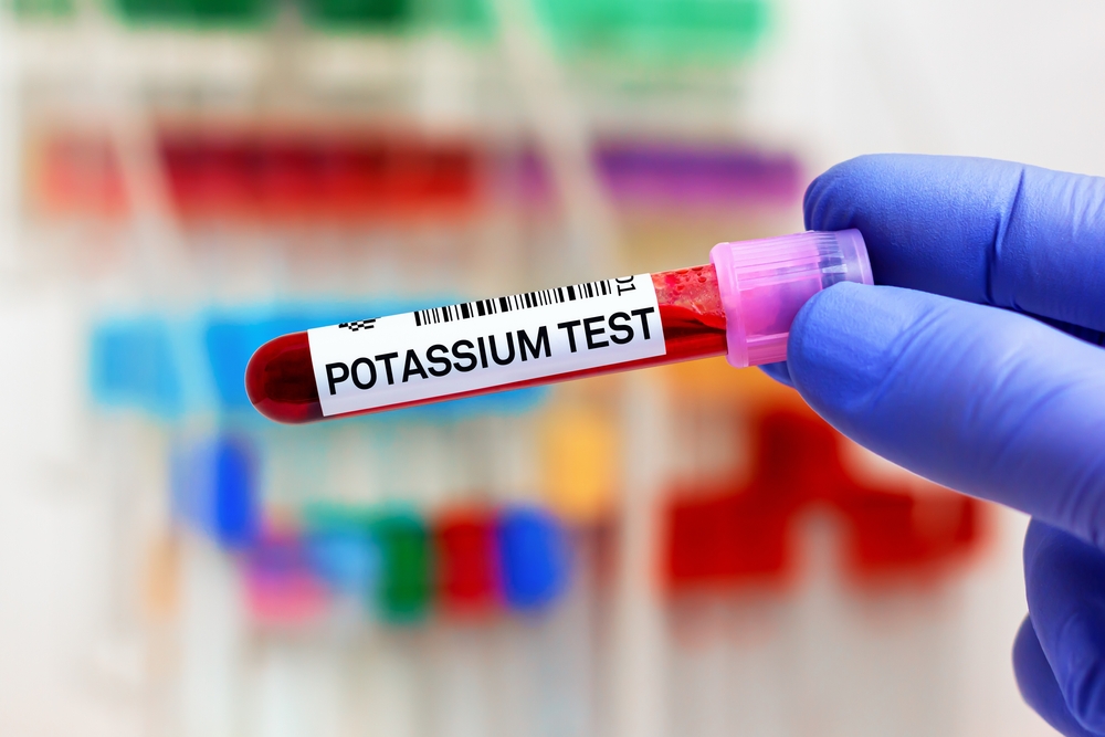 Blood sample of patient for Potassium test in laboratory. doctor with Blood tube and needle for Potassium test