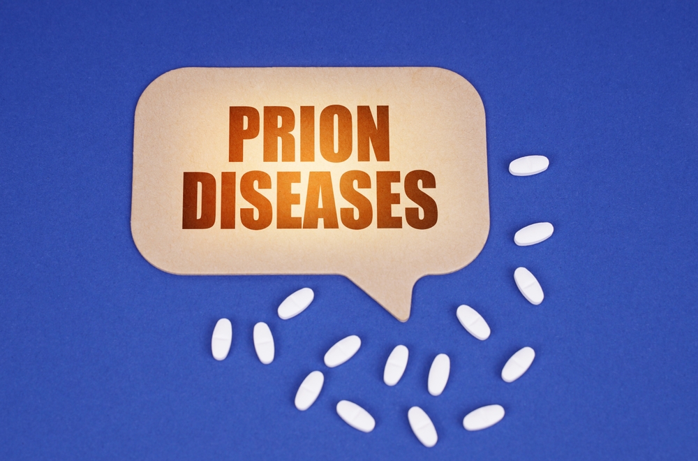 Medical concept. On the blue surface of the tablet and a cardboard plate with the inscription - Prion diseases