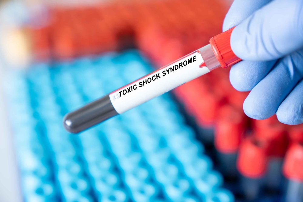 Toxic Shock Syndrome. Toxic Shock Syndrome disease blood test inmedical laboratory