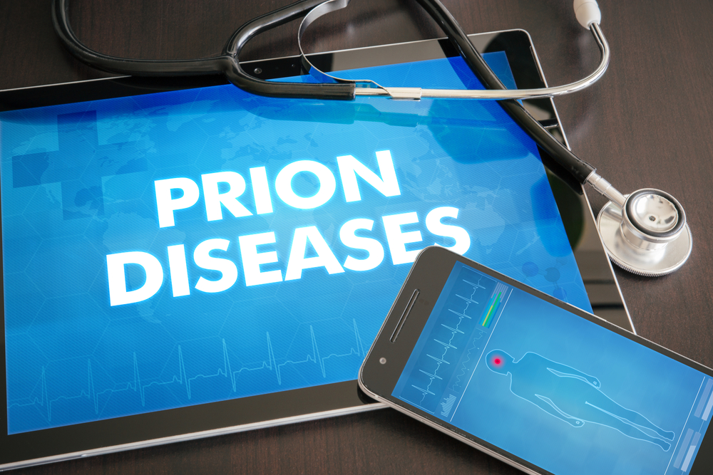 Prion diseases (neurological disorder) diagnosis medical concept on tablet screen with stethoscope.