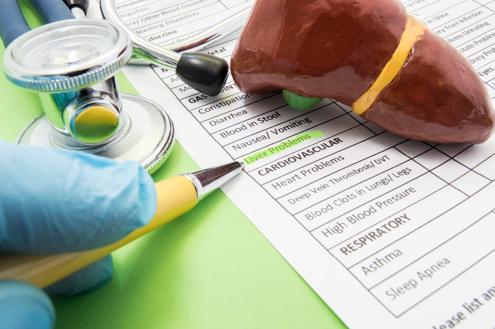 Liver problems concept photo. The doctor points in diagnosis process to inscription Liver problems on a sheet of the medical history of the patient, which lies near the shape of liver and stethoscope
