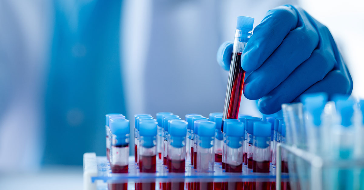 laboratory tech handling vials of blood