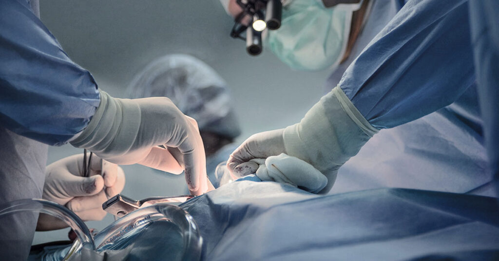 Young Woman Goes Viral After Revealing Stunning Results of Her Jaw Surgery - Featured image