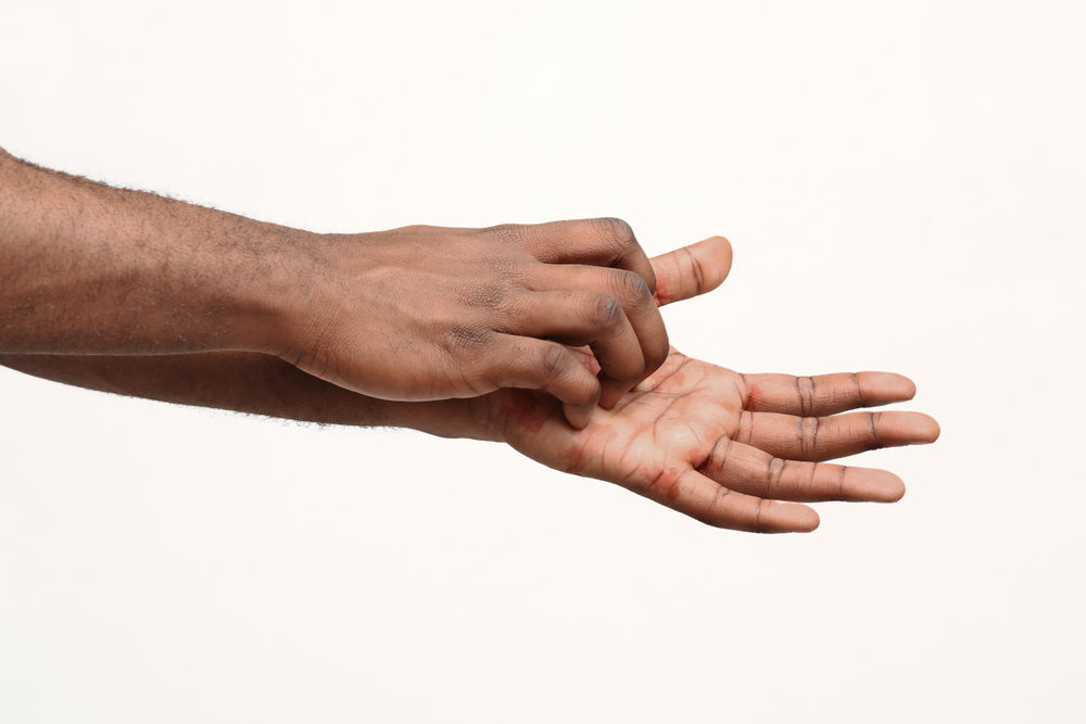 Dermatitis. Afro man scratching itch on his hand, cropped, white background