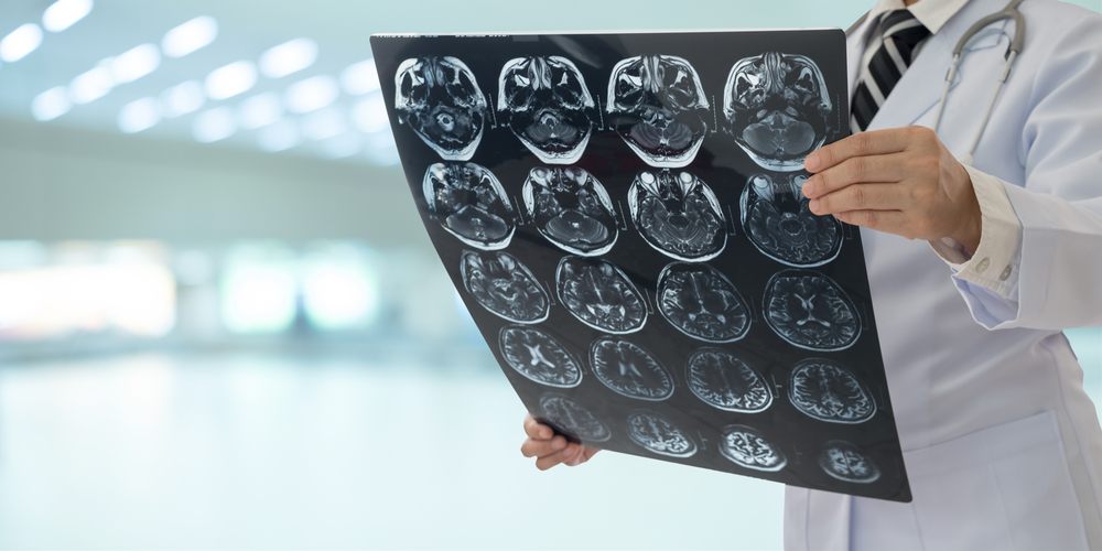 radiology doctor examines film x-ray brain by ct scan mri of the patient.
