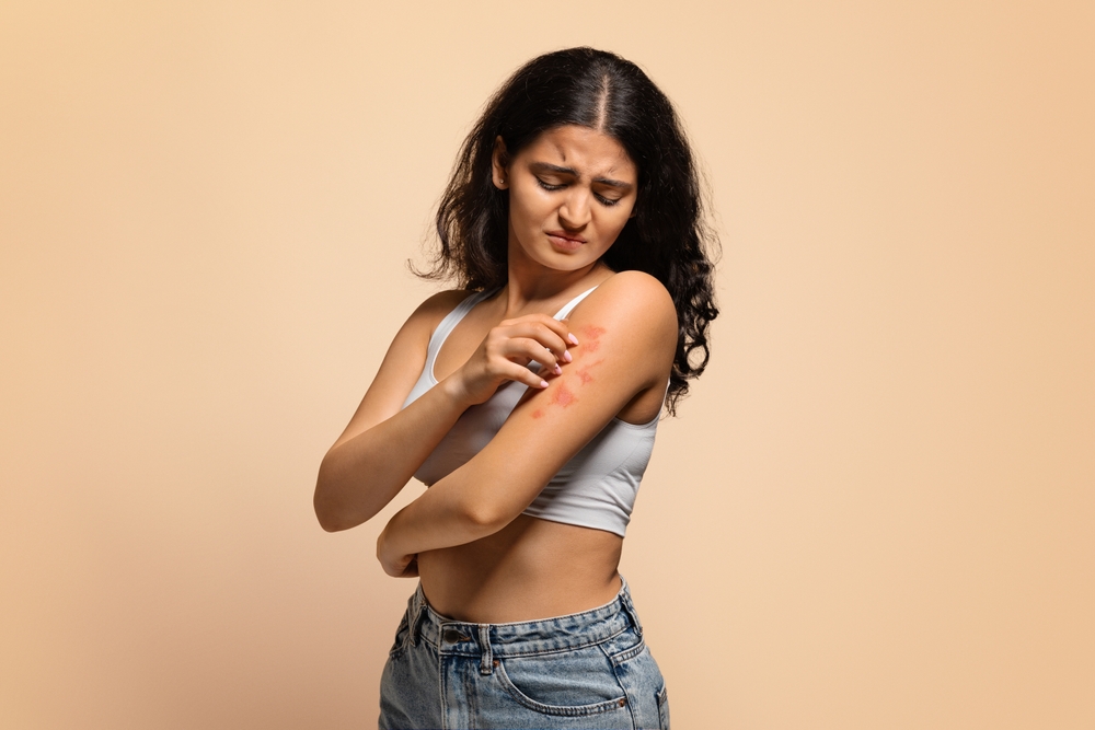 Dermatitis, eczema, allergy, psoriasis concept. Annoyed young indian woman scratching irritated skin on arm, eastern female having itching rash on body, standing on beige studio background