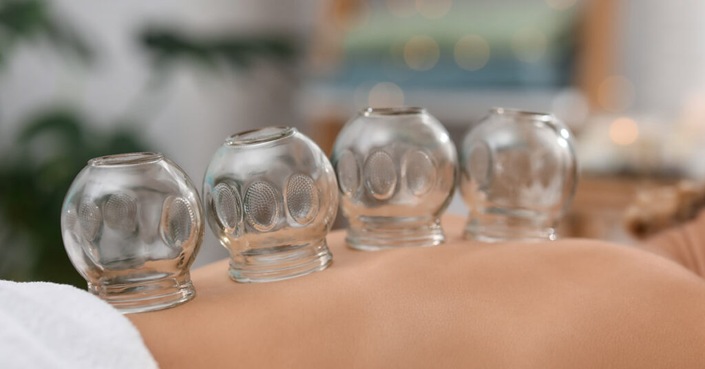 Olympians Spotted With ‘Cupping’ Marks On Their Bodies. Does It Work? Here’s What The Science Says - Featured image