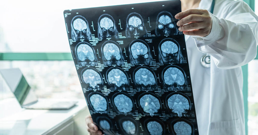 Neurologist reveals the single scariest thing she sees people doing to their brains - Featured image