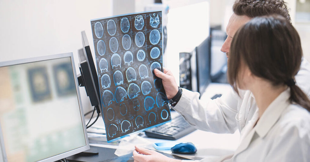 Strokes Are On The Rise In Young People, And These Are The Reasons Why - Featured image