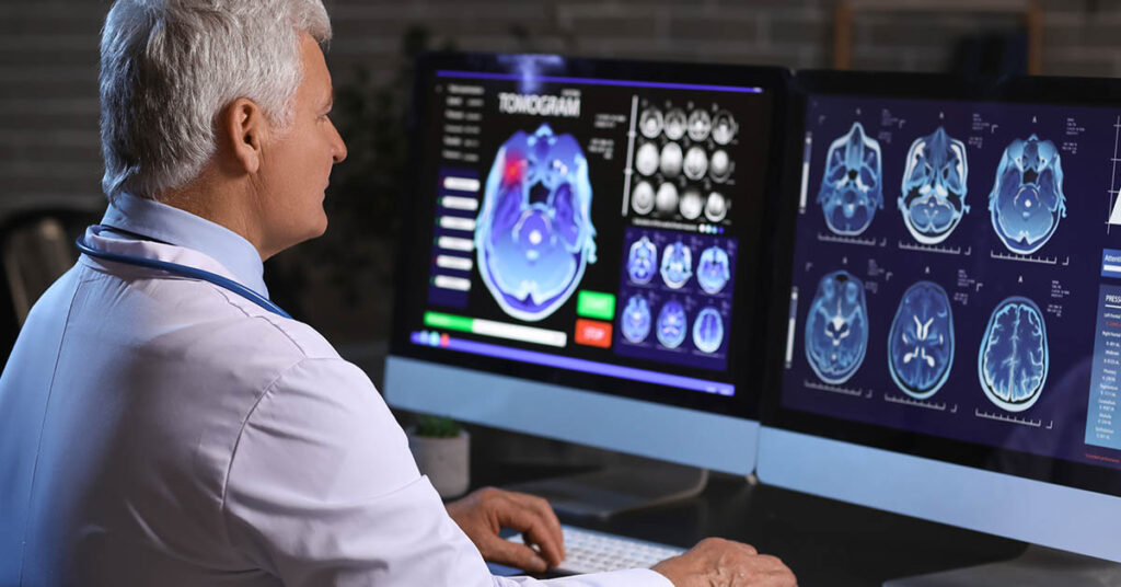 Reducing Your Intake of This One Food Can Lower Your Dementia Risk - Featured image