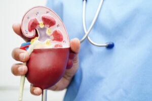 Creatinine Levels: When to Worry About High and Low Creatinine