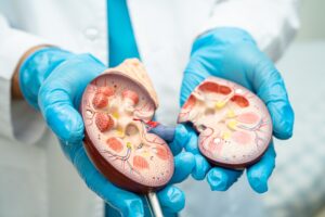 Creatinine Levels: When to Worry About High and Low Creatinine