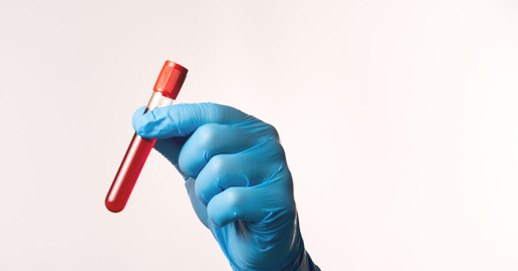 6 Things To Do Before Getting a Blood Test, According to Doctors - Featured image