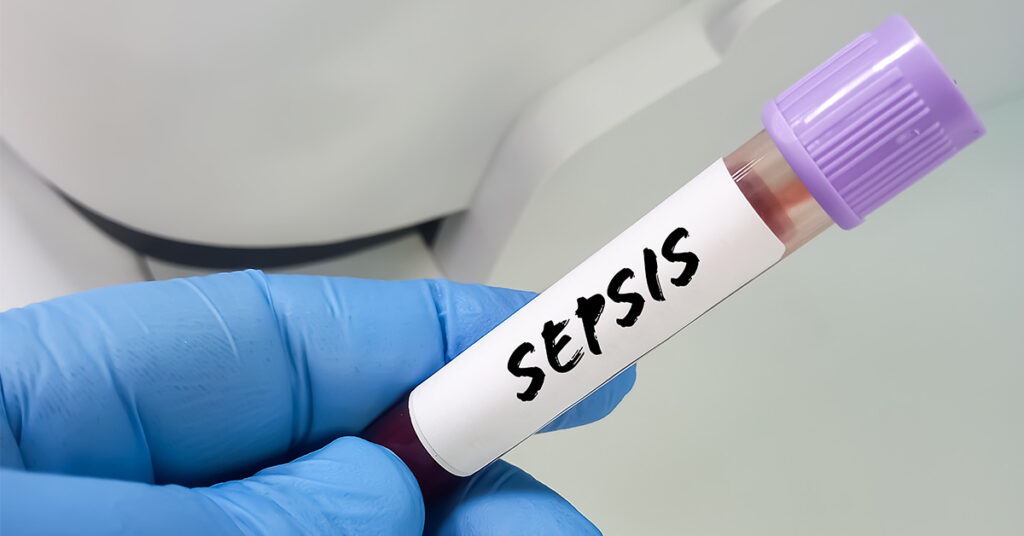 Student Nurse Dies Of Sepsis After Believing She Was Just ‘Run Down’ From Long Shifts - Featured image
