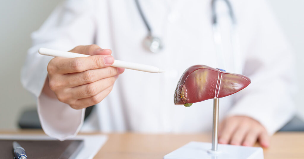 11 Early and Advanced Symptoms of Cirrhosis You Should Be Aware Of - Featured image