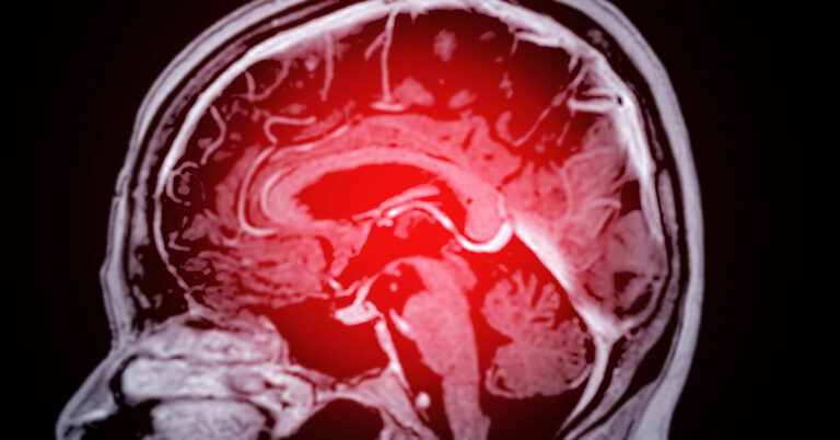 Just One Habit in Your 40s Can Lead to Faster Brain Aging - Featured image